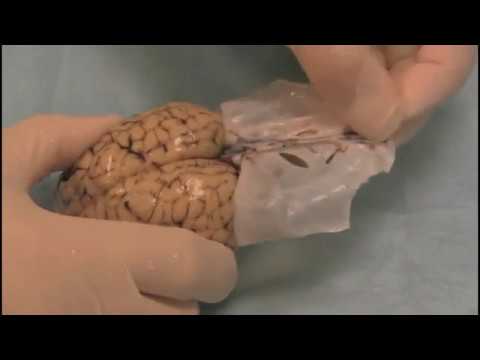 Thumbnail for Sheep Brain Dissection - Center for Science Education by TUSM Center for Science Education