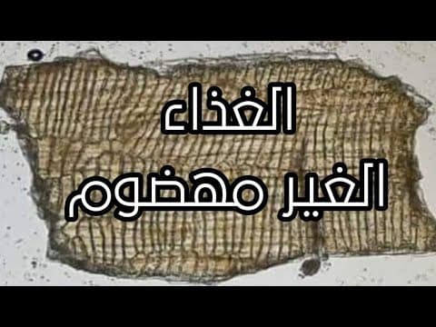 Thumbnail for undigested food & artifacts by Mo Sileem medical lab محمد سليم التحاليل الطبية 