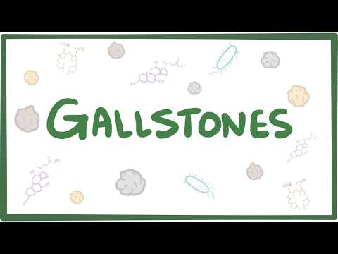 Thumbnail for Gallstones (cholelithiasis) by Osmosis from Elsevier