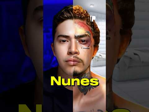 Thumbnail for O QUE￼ ￼ACONTECEU COM WHINDERSSON NUNES? - Peraltas Comedy #whinderssonnunes #peraltascomedy #shots by Peraltas Comedy 