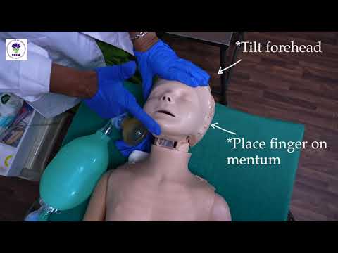 Thumbnail for Airway Assessment by Prof. Dr.Indumathy Santhanam MD DCH,