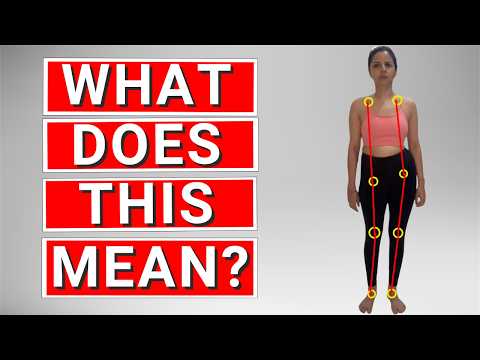 Thumbnail for Hidden Scoliosis Patterns You Can Fix by Ed Paget