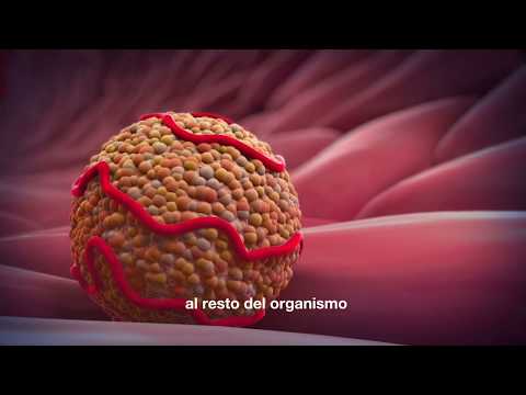 Thumbnail for ¿Cómo se forma la placa de ateroma? by Amgen España
