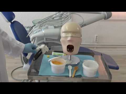 Thumbnail for Toma de impresion con silicona by Alejandro Diaz. ETEE. Dental