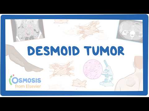 Thumbnail for Desmoid Tumor (NORD) (2026 update) by Osmosis from Elsevier