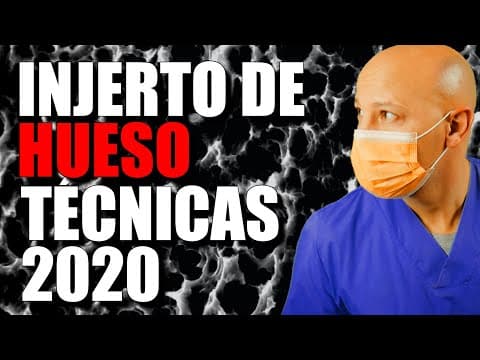 Thumbnail for TIPOS de INJERTOS de HUESO 🔴GUÍA DEFINITIVA🔴 by TU DENTISTA VIRTUAL