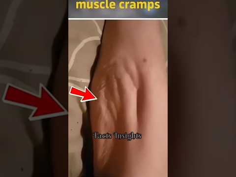 Thumbnail for What Causes Muscle Cramps? 😲 by FactsInsights