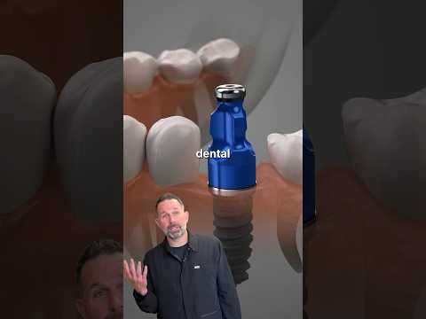 Thumbnail for Should you get dental implants? What to know first from a cosmetic dentist by Dr.Andrew Hall