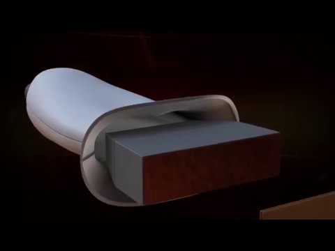 Thumbnail for Ultrasound by Pedro J. Serrano