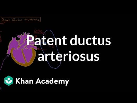 Thumbnail for Patent ductus arteriosus | Circulatory System and Disease | NCLEX-RN | Khan Academy by khanacademymedicine
