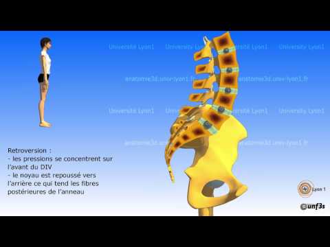 Thumbnail for Placement du bassin La charnière lombo-sacrée by Anatomie 3D Lyon