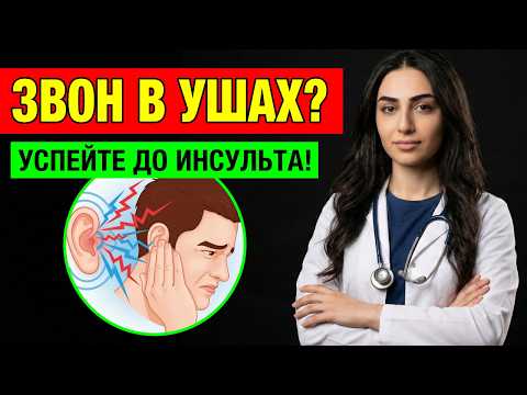 Thumbnail for Как не пропустить предынсультное состояние — объясняет врач by Доктор Мари Оганян