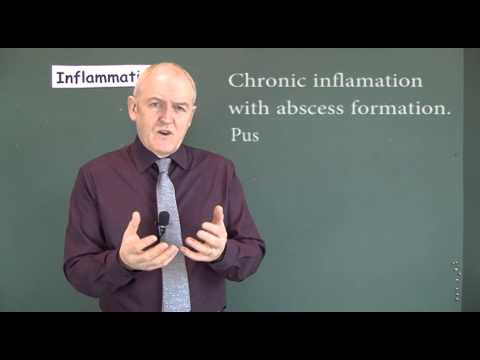 Thumbnail for Inflammation 8, Outcomes of Inflammation by Dr. John Campbell