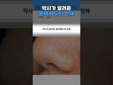 Thumbnail for 약사가 알려준 블랙헤드의 정체 by 방구석 친구들