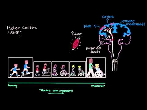 Thumbnail for Khan Academy - Types of Cerebral Palsy Part 1: Spastic by Emma Giles