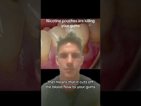 Thumbnail for Nicotine pouches are destroying your gums! by Dr James Esler