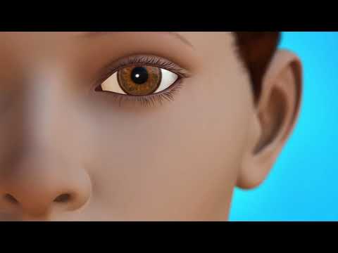 Thumbnail for External DCR by Concord Eye Center NH