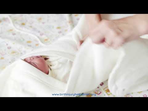 Thumbnail for Sandifer Syndrome by Birth Injury Help Center