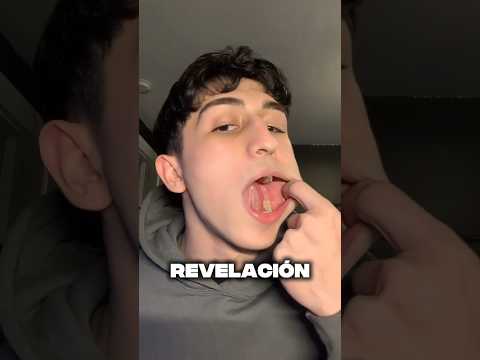 Thumbnail for Lo que hizo para evitar tomarse la pastilla 🤯💊 (@gregsabbak) by HE Xperience