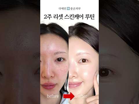 Thumbnail for 🚨피부 뒤집혔을 때! 2주 리셋 스킨케어 루틴 4가지✨ #shorts by 이리유 iliyu