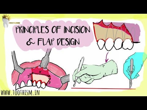 Thumbnail for Principles of INCISION MAKING and FLAP DESIGN | Basic Principles of Oral Surgery by TaughtWell SimplifyEd