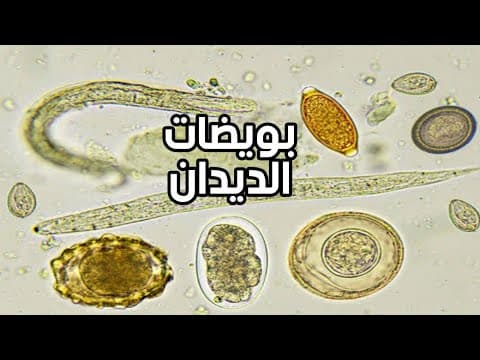 Thumbnail for worms ova & worms larvae by Mo Sileem medical lab محمد سليم التحاليل الطبية 