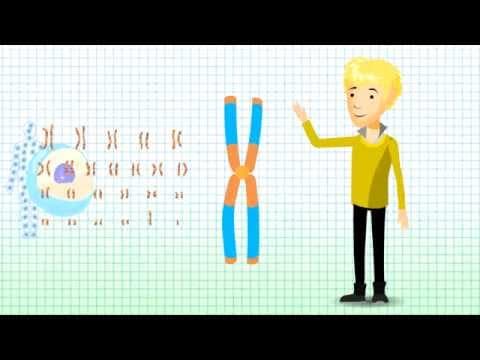 Thumbnail for Understanding Chromosomal Translocation - Robertsonian Translocation v1.2 by UCD Medicine