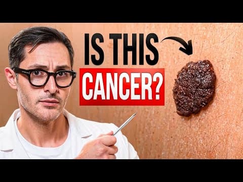 Thumbnail for The Mole You Should Never Ignore: Warning Signs That Could Save Your Life by Doctor Dzari