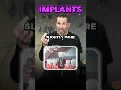 Thumbnail for The Cost of Dental Implants? #dentalimplants #implants by Dr.Andrew Hall