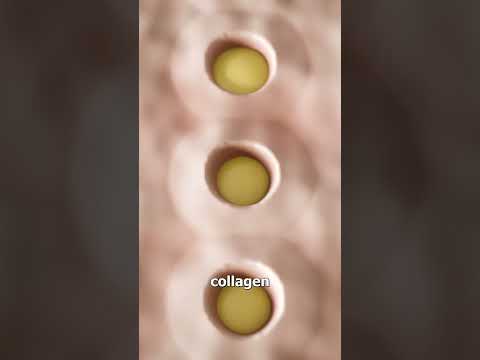 Thumbnail for How A Derma Roller Works 🤔 by Zack D. Films