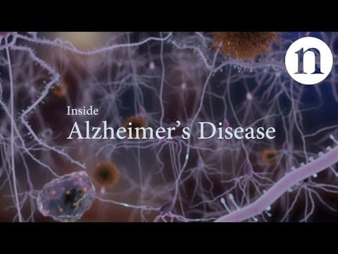 Thumbnail for Inside Alzheimer’s disease by nature video