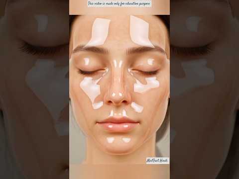 Thumbnail for चेहरा कांच जैसा चमकेगा 😊 बस ये 3 आसान तरीक़े अपनालो✅#shorts#beauty#skincare#fypシ゚viral#diy#glassskin by MedFact Hindi