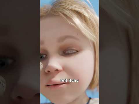 Thumbnail for How A Simple Kiss Nearly Destroyed His Eye ๐ข by Zack D. Films