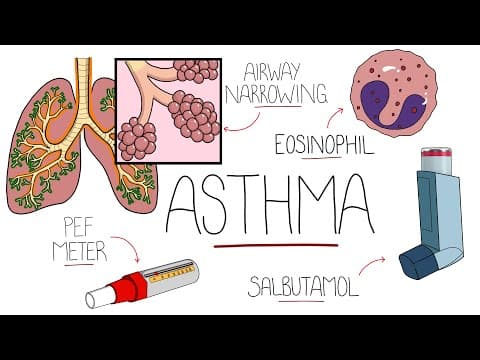 Thumbnail for Asthma Explained (Including Pathophysiology) by Rhesus Medicine