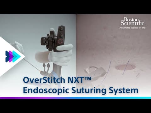Thumbnail for OverStitch NXT™ Endoscopic Suturing System Animation Video | Boston Scientific by Boston Scientific EMEA