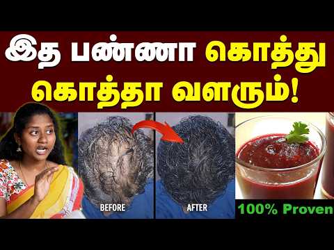 Thumbnail for Super Food: அடர்த்தியான முடி வளர்ச்சிக்கு 7 அற்புத உணவுகள்🔥|Hair Growth Expert Shares Top 7 Secrets by Theneer Idaivelai