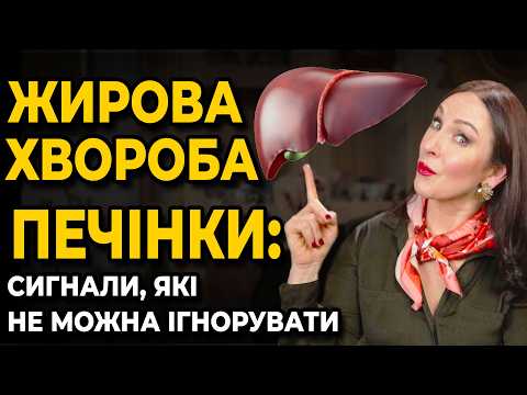 Thumbnail for Повна версія! 70% людей не знають, що у них "жирна" печінка. В чому небезпека? by Oksana Skytalinska
