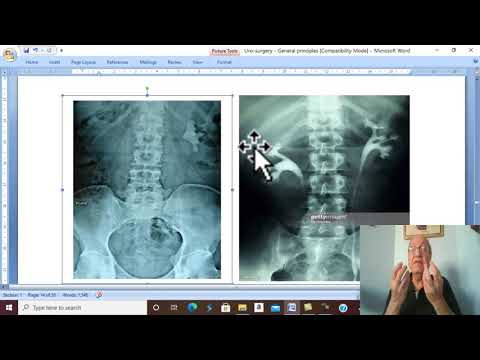 Thumbnail for Urosurgery in Arabic 4 (Urinary Stones (General Principles ), part 4 ) , by Dr. Wahdan by Learn with Dr. Wahdan 2