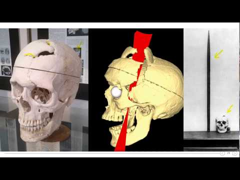 Thumbnail for Neurociencias 1, HISTORIA DE LAS NEUROCIENCIAS Primera parte by Jorge Quiroga