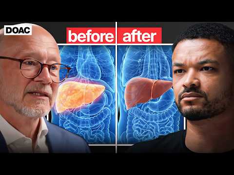 Thumbnail for The SIMPLE Way To Clean Your FATTY Liver (Science Backed) by The Diary Of A CEO Clips