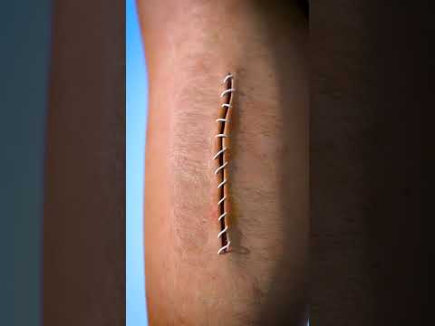 Thumbnail for How Stitches Work ๐ฏ by Zack D. Films