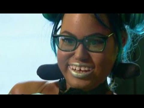 Thumbnail for Teen with incurable disease waging right to die battle by Fox News
